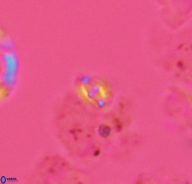 Crucibiscutum salebrosum 2936