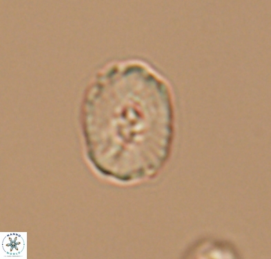 Cruciellipsis cuvillieri cuvillieri 10615