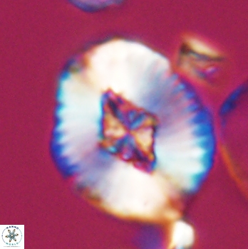 Cruciellipsis cuvillieri grandis 11158
