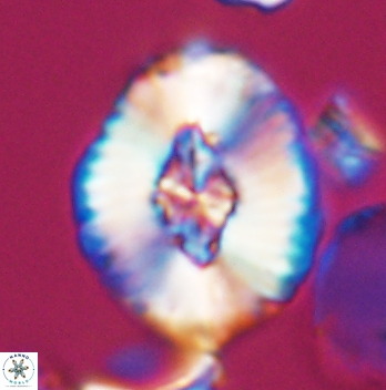 Cruciellipsis cuvillieri grandis 11160