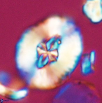 Cruciellipsis cuvillieri grandis 11162