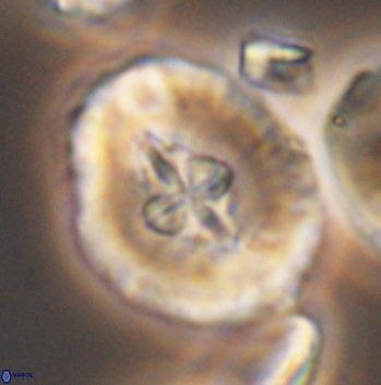 Cruciellipsis cuvillieri grandis 11163