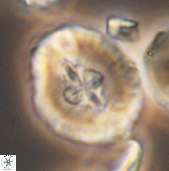 Cruciellipsis cuvillieri grandis 11163