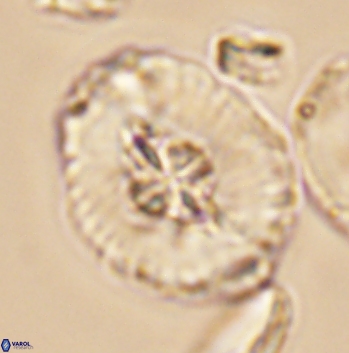 Cruciellipsis cuvillieri grandis 11164