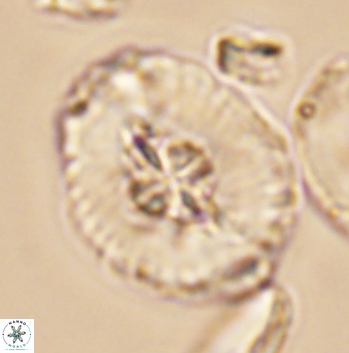Cruciellipsis cuvillieri grandis 11164