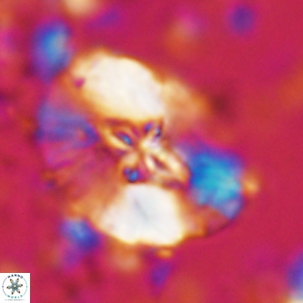 Cruciellipsis cuvillieri grandis 1331