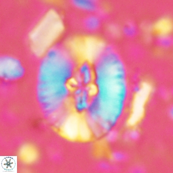 Cruciellipsis cuvillieri grandis 2047