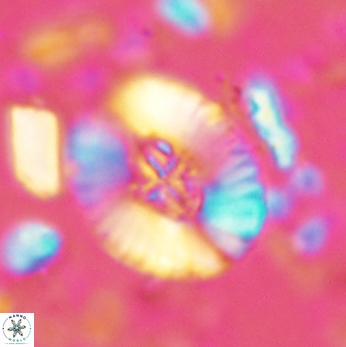 Cruciellipsis cuvillieri grandis 2049