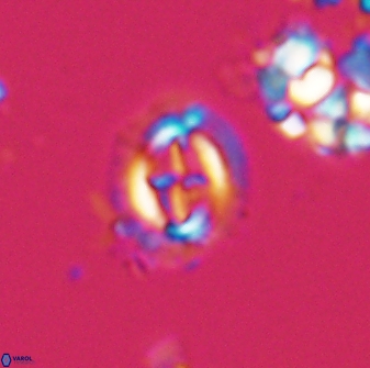 Cruciplacolithus oulchyensis 22655