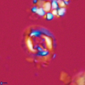 Cruciplacolithus oulchyensis 22657