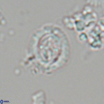 Cruciplacolithus oulchyensis 22661