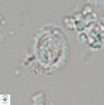 Cruciplacolithus oulchyensis 22661
