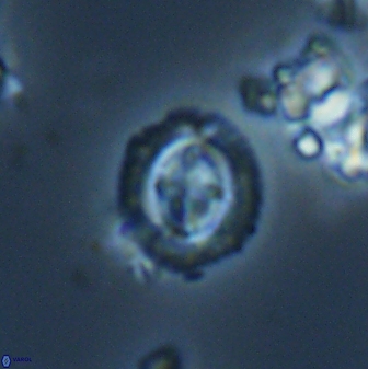 Cruciplacolithus oulchyensis 22662