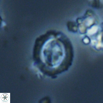 Cruciplacolithus oulchyensis 22662