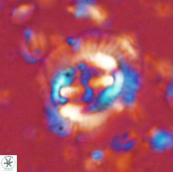 Cruciplacolithus asymmetricus 43643