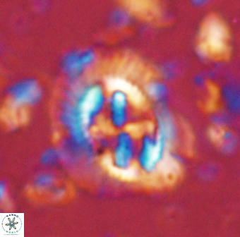 Cruciplacolithus asymmetricus 43645