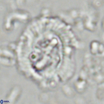 Cruciplacolithus asymmetricus 43647