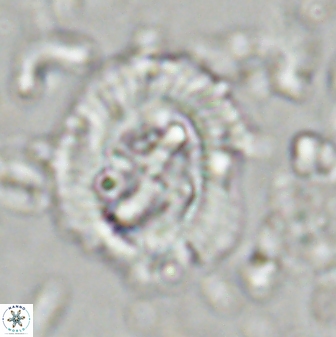 Cruciplacolithus asymmetricus 43647