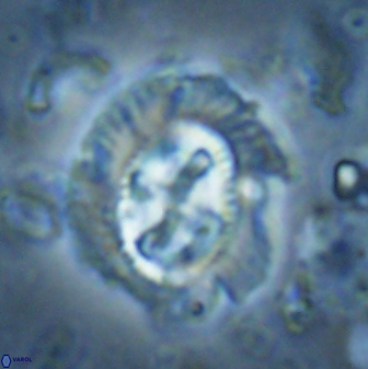 Cruciplacolithus asymmetricus 43648