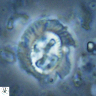Cruciplacolithus asymmetricus 43648