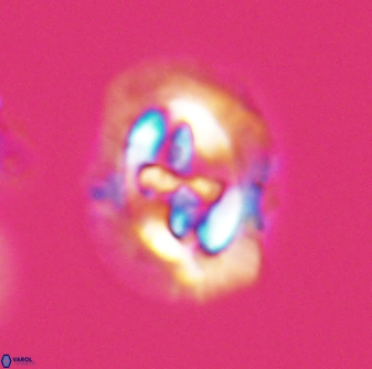 Cruciplacolithus asymmetricus 22919