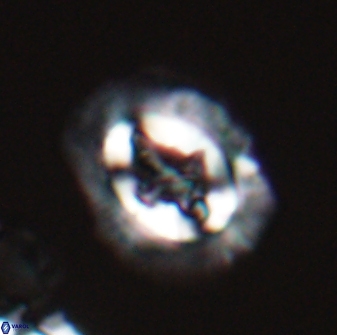 Cruciplacolithus asymmetricus 22920