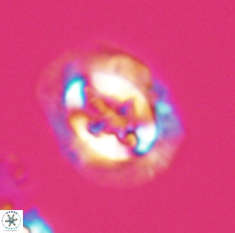 Cruciplacolithus asymmetricus 22921