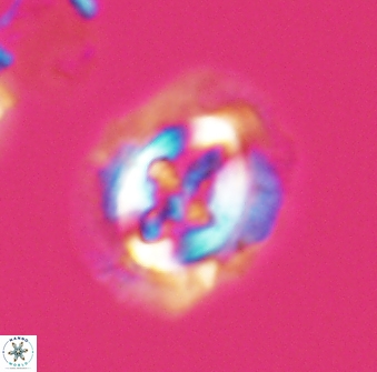 Cruciplacolithus asymmetricus 22923