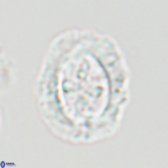 Cruciplacolithus asymmetricus 22924