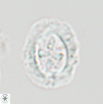 Cruciplacolithus asymmetricus 22924