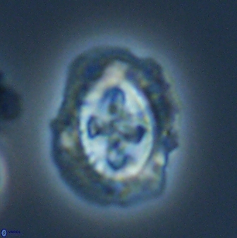 Cruciplacolithus asymmetricus 22925