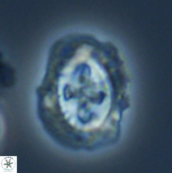 Cruciplacolithus asymmetricus 22925