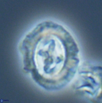 Cruciplacolithus asymmetricus 22926