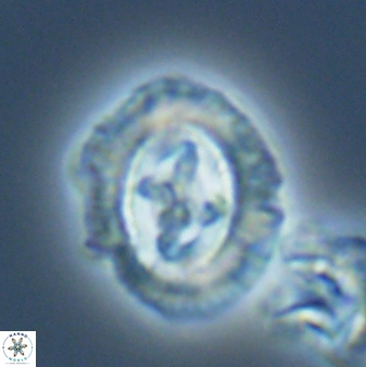 Cruciplacolithus asymmetricus 22926