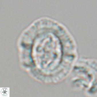 Cruciplacolithus asymmetricus 22927