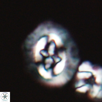 Cruciplacolithus asymmetricus 22928