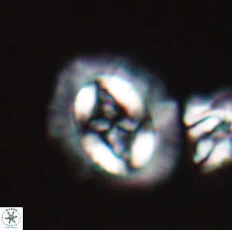 Cruciplacolithus asymmetricus 22930