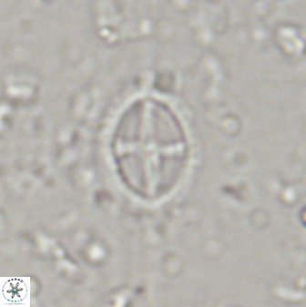 Cruciplacolithus curucifer 33341