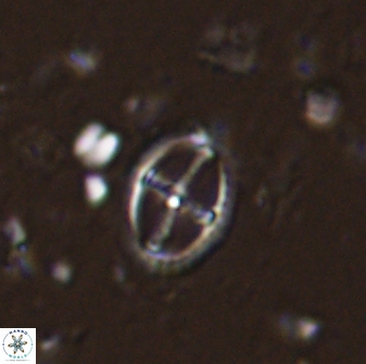 Cruciplacolithus curucifer 33336