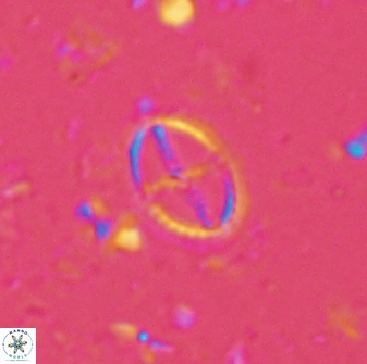 Cruciplacolithus curucifer 33338