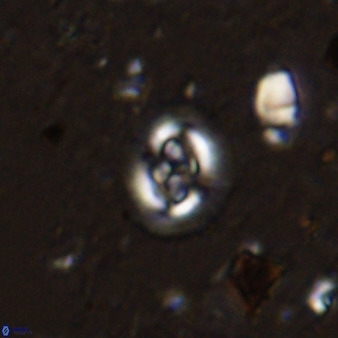 Cruciplacolithus cf latipons 50628