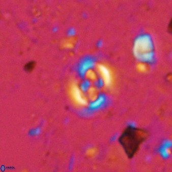 Cruciplacolithus cf latipons 50629