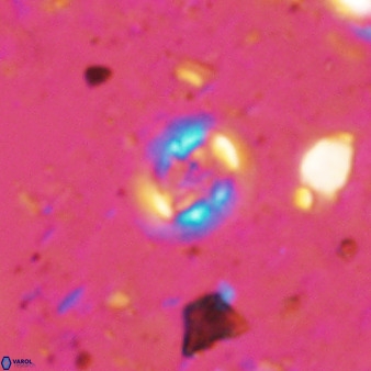 Cruciplacolithus cf latipons 50634