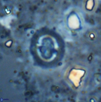 Cruciplacolithus cf latipons 50635