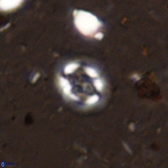 Cruciplacolithus cf latipons 50630