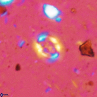 Cruciplacolithus cf latipons 50632