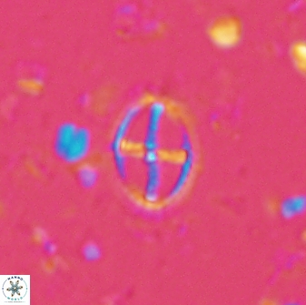 Cruciplacolithus crucifer 33334