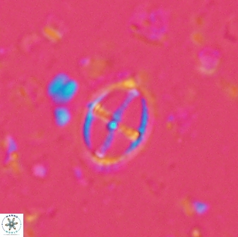 Cruciplacolithus crucifer 33335