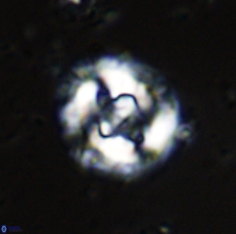 Cruciplacolithus dyoepipeda 42639