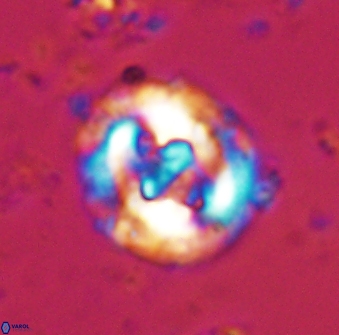 Cruciplacolithus dyoepipeda 42640